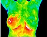 thermography